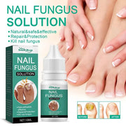 Nail Fungus Treatments Serum for healthy growth